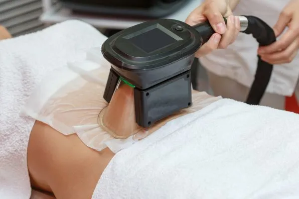 Image of person having fat freezing treatment to help weight gain Handsworth