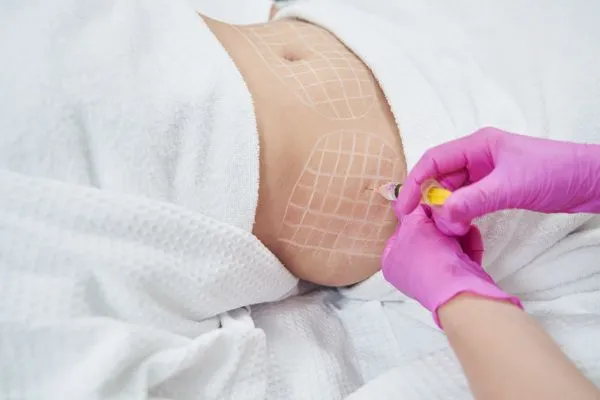 image of fat dissolving injections on love handles to help combat weight gain Handsworth