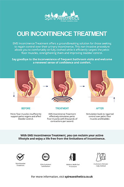 image of how urge incontinence Handsworth treatment works